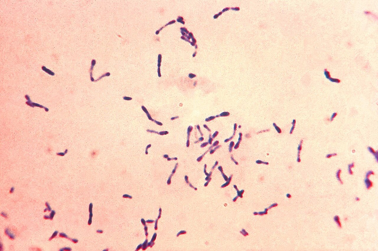 La bactérie de la diphtérie au microscope
