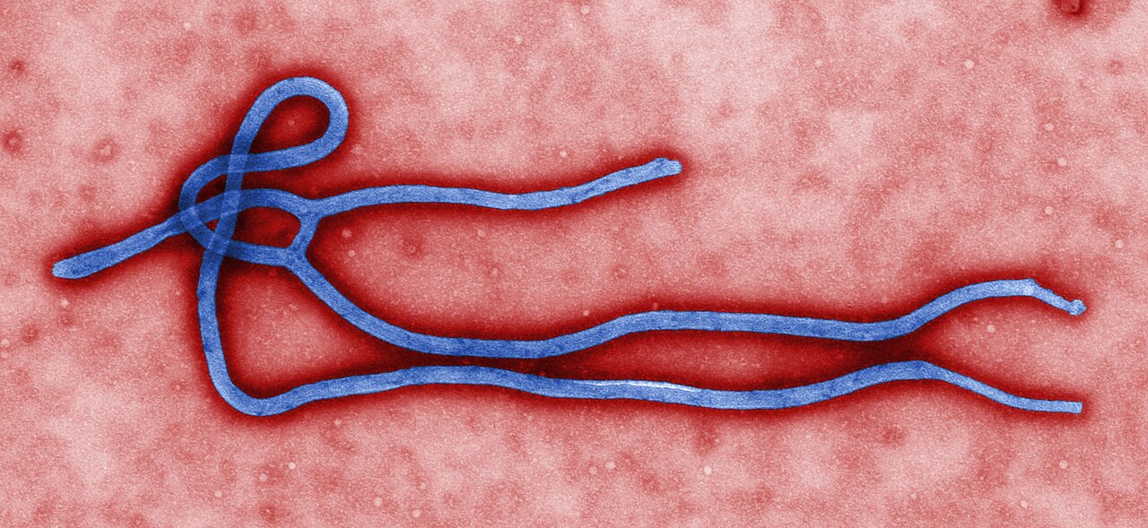 Le virus Ebola vu au microscope électronique